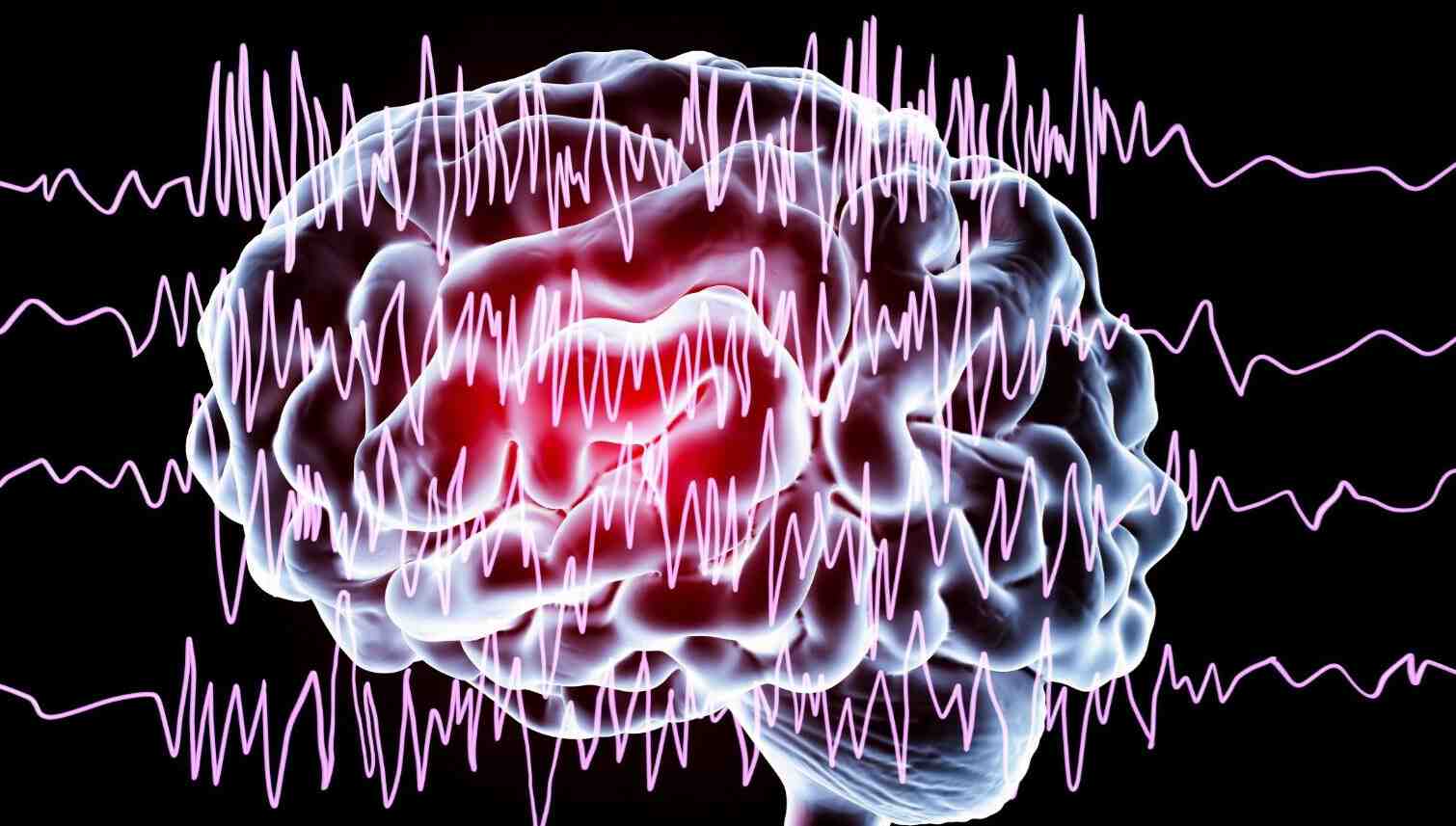 Endoskopik reflü tedavisinde güncel yöntemler nelerdir? 