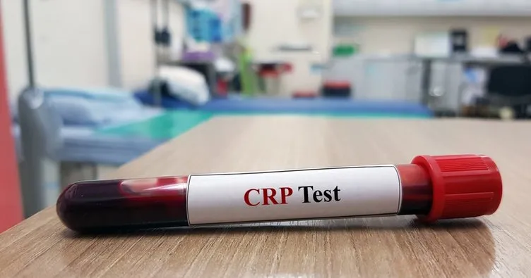 CRP Nedir? Kanda CRP Değeri Yüksekliği Ve Düşüklüğü Ne Anlama Gelir, Normal Değerleri ve Referans Aralığı Kaçtır?