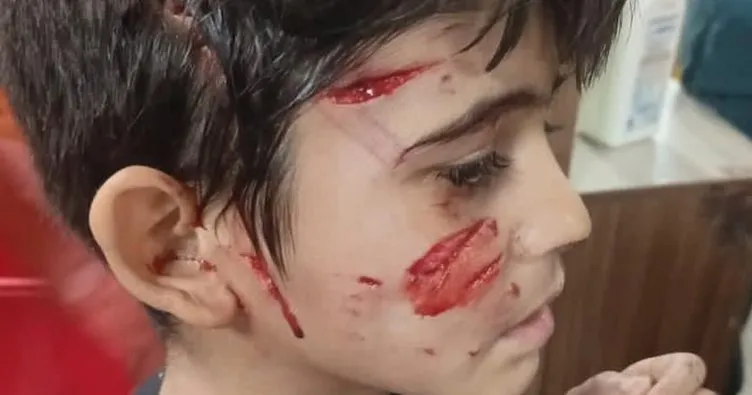 Gaziantep’te köpek dehşeti! 8 yaşındaki çocuğa 5 köpek saldırdı