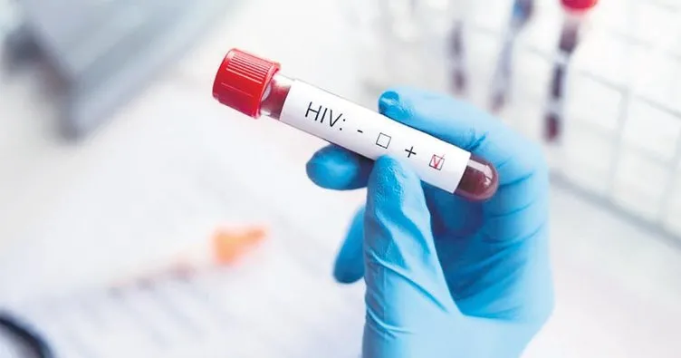 HIV pandemisi dakikada 1 kişi HIV’den ölüyor