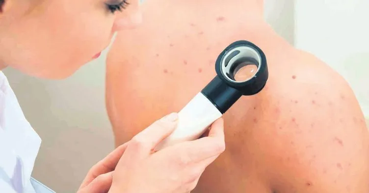 Kreş ve anaokullarında bulaşıcı hastalıklara dikkat