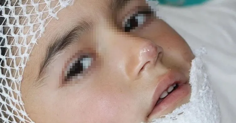 Pilav kazanında yanan Ferid’in hayatta kalma mücadelesi