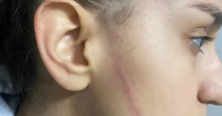 Bingöl’de yaşanan hentbol olayı ile ilgili valilikten açıklama