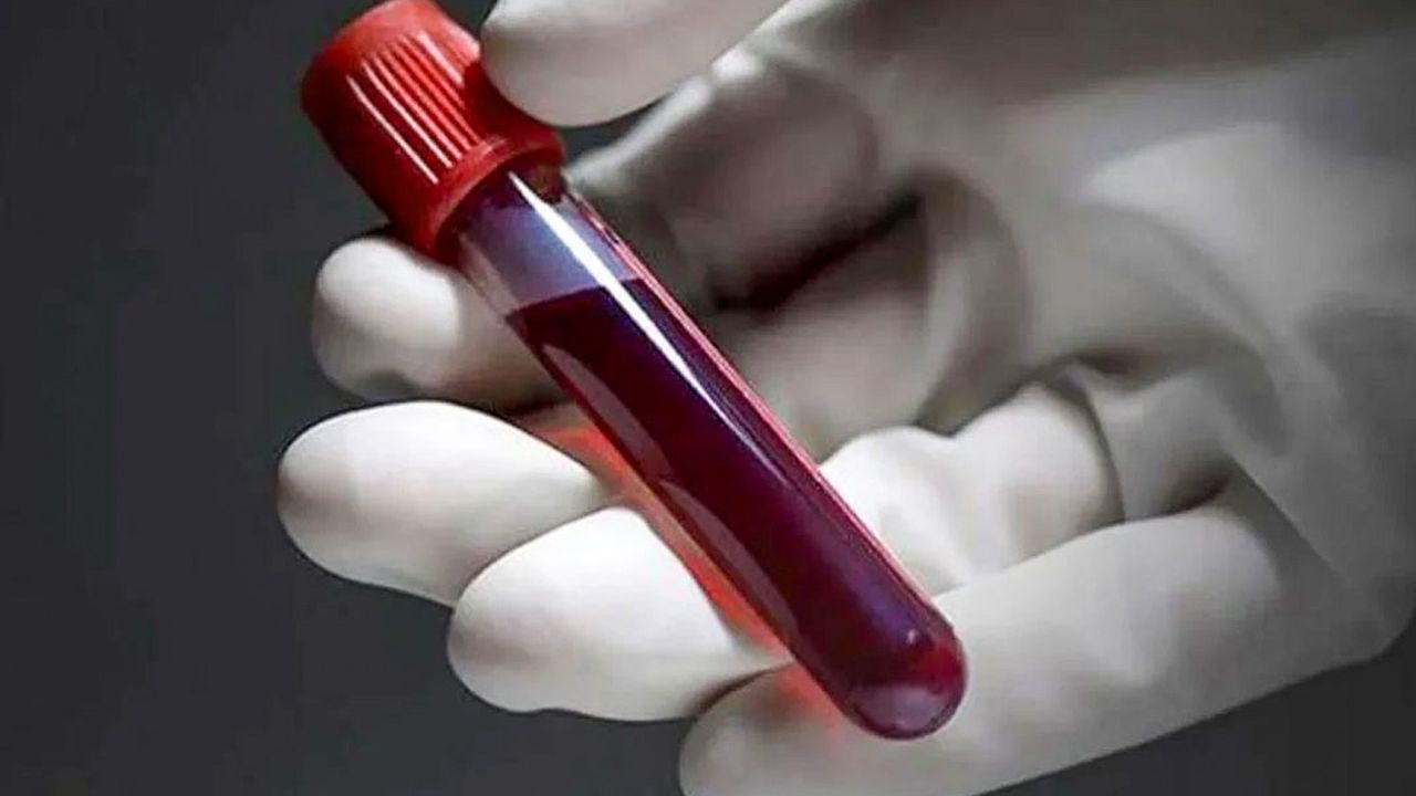 AB kan grubuna sahip olanlarda hafıza kaybı riski iki kat