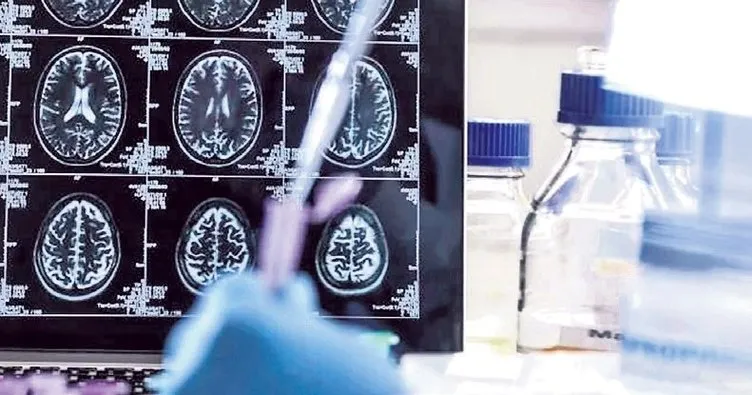 Alzheimer teşhisinde kan testi devrimi