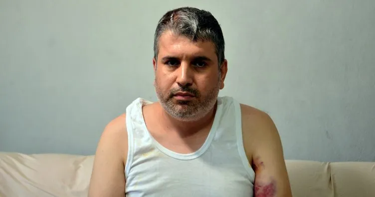 “Kadına miras yok” dedi, yeğenini  beyzbol sopasıyla öldüresiye darp etti