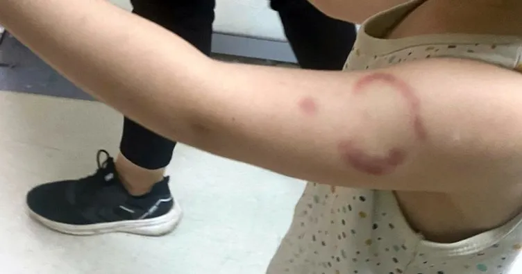 Edirne’de öğrencisini ısırdığı iddiasıyla gözaltına alınmıştı: O kadın hakkında karar çıktı! ‘Çocuğum travma geçirdi’