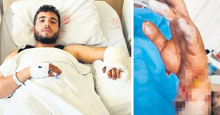 Ankara’da köpek dehşeti! MS hastası genç ağır yaralandı! “Kolundaki dokular ölmeye başlamış”