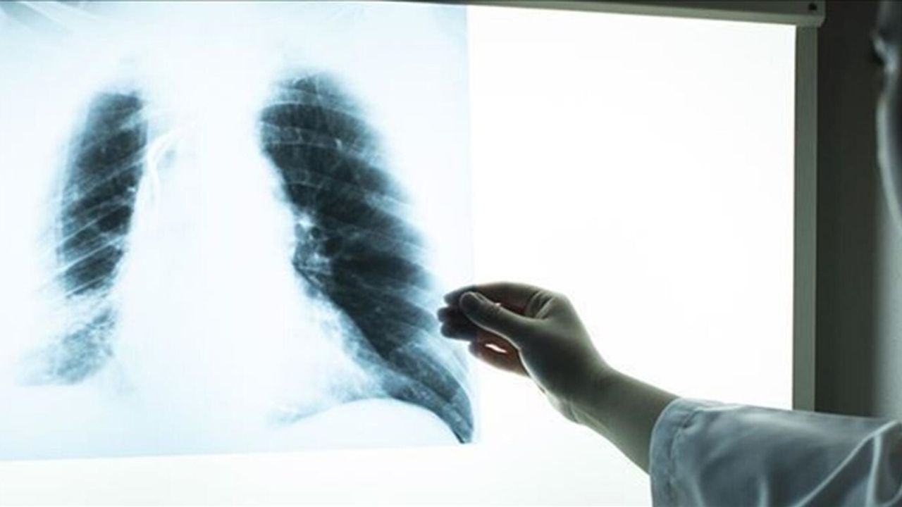 İklim değişikliği KOAH hastalarının alevlenme sıklığını artırıyor