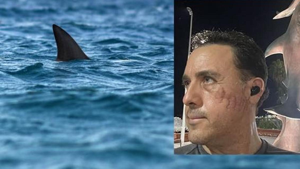 40 metre derinlikte dehşet! Köpek balığı saldırısından sağ kurtuldu: “Birden çenesini tekrar açtı, isteseydi öldürebilirdi”