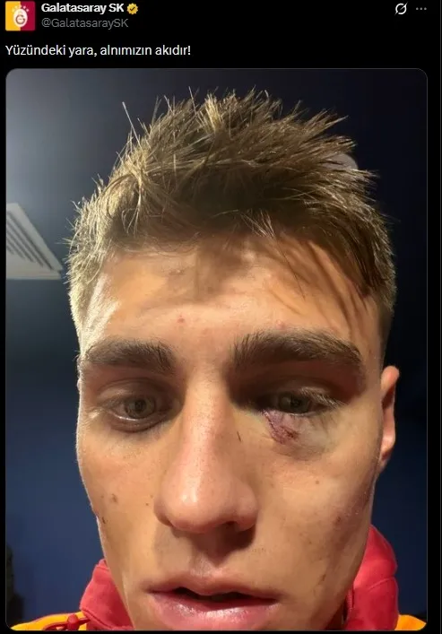 Galatasaray’dan Kazımcan Karataş paylaşımı: “Yüzündeki yara, alnımızın akıdır!”