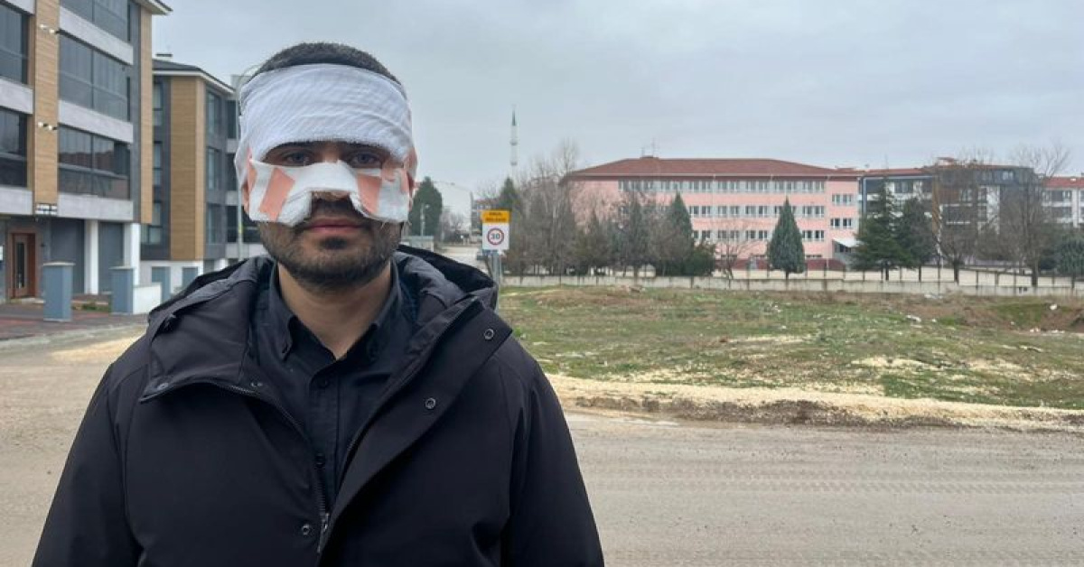 Öğretmen, meslektaşının yüzüne sıcak çay fırlattı!