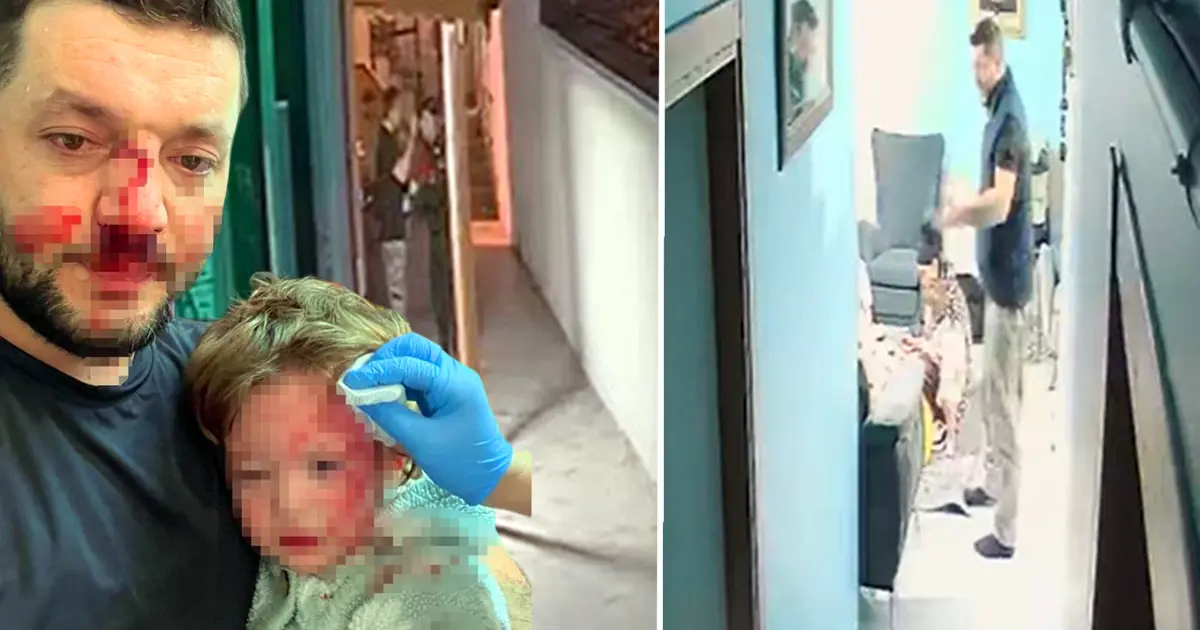 Baba ve 14 aylık kızına saldırı davası. Tutuklu sanık tahliye edildi