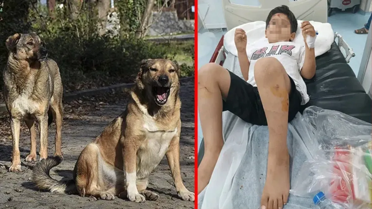 Bakanlık harekete geçti! Viranşehir’deki köpek saldırısına mülkiye müfettişi