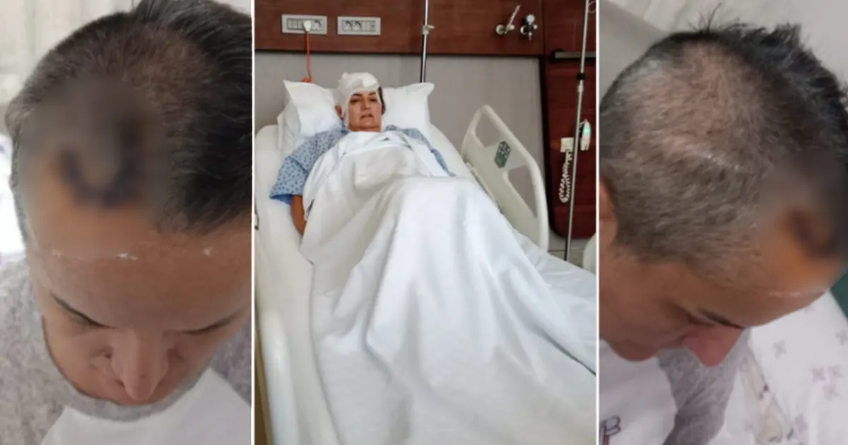 Diş ağrısı için gitti hayatı karardı. Şimdi beyninde ömür boyu cihazla yaşayacak