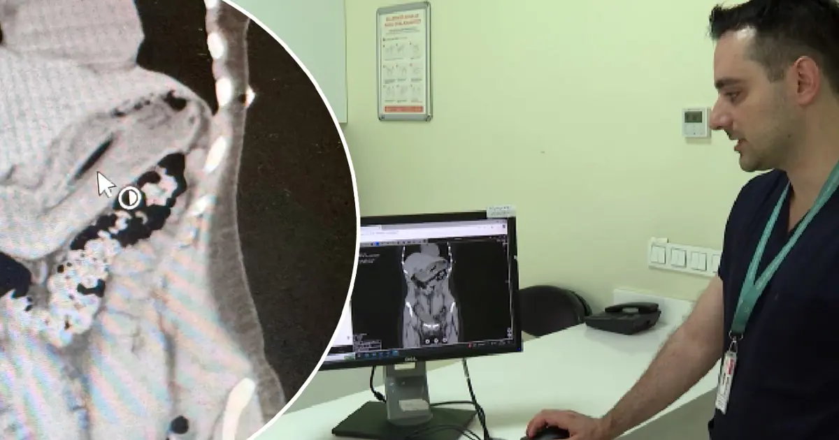 Zayıflamak isterken diş fırçası yuttu!